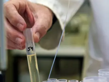 hallan una nueva vía de ataque para vencer al cáncer hallan una nueva vía de ataque para vencer al cáncer