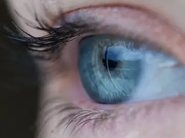Diagnostican a una niña de cinco años varios tumores oculares en un ojo Diagnostican a una niña de cinco años varios tumores oculares en un ojo