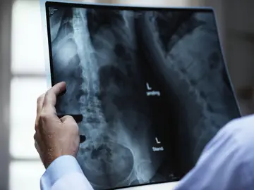 Radiólogo analizando una radiografía Radiólogo analizando una radiografía