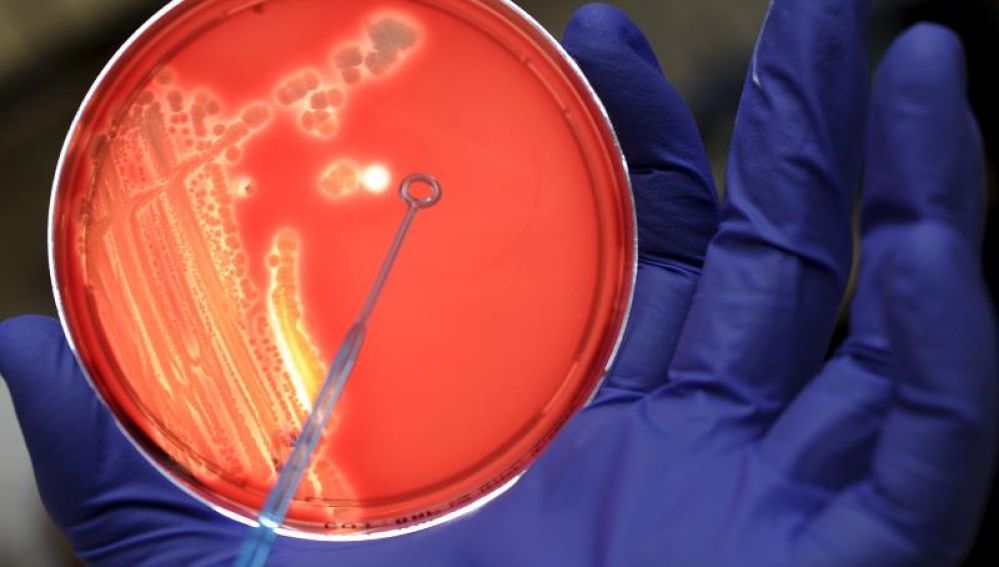 Un asistente de laboratorio examina una colonia de bacterias en un cultivo