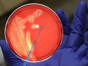 Un asistente de laboratorio examina una colonia de bacterias en un cultivo Un asistente de laboratorio examina una colonia de bacterias en un cultivo
