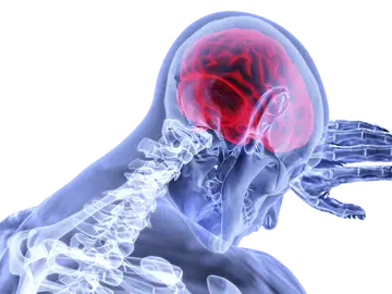 Ictus Ictus