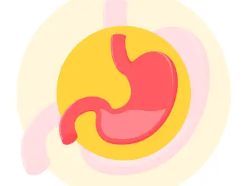 Las úlceras y la bacteria Helicobacter pylori Las úlceras y la bacteria Helicobacter pylori
