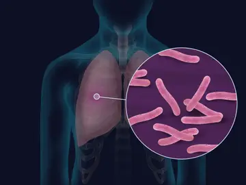Imagen de la bacteria Mycobacterium tuberculosis Imagen de la bacteria Mycobacterium tuberculosis