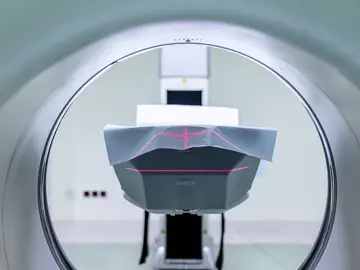 Resonancia magnética Resonancia magnética