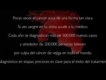 El grupo oncológico GO NORTE lanza una campaña de concienciación para prevenir el cáncer de vejiga 