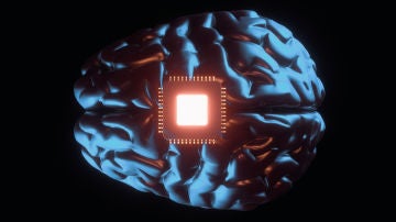 Neurotecnología y derechos Neurotecnología y derechos