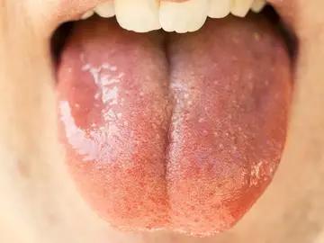 Saliva Saliva