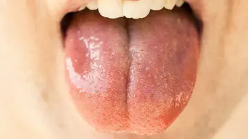 Saliva Saliva