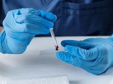 Nueva tecnología para el diagnóstico médico Nueva tecnología para el diagnóstico médico