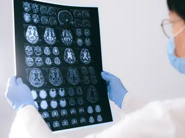 Médico observando un escáner cerebral Médico observando un escáner cerebral