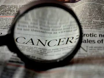 Así son las pruebas de cribado del cáncer de colon: si se detecta precozmente, el 90% de los casos se curan Así son las pruebas de cribado del cáncer de colon: si se detecta precozmente, el 90% de los casos se curan