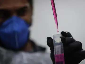 Hepatitis infantil: qué es y cómo se contagia Hepatitis infantil: qué es y cómo se contagia
