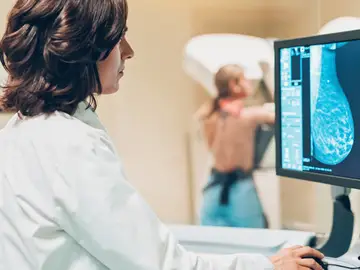 Imagen de una mamografía Imagen de una mamografía