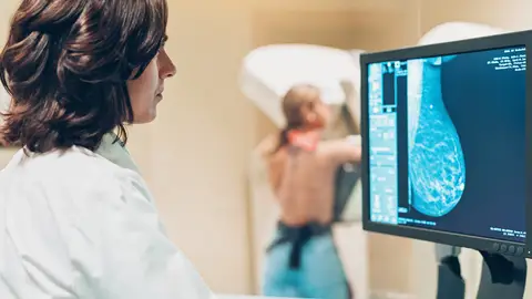 Imagen de una mamografía Imagen de una mamografía