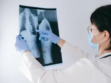 Avances para el desarrollo de nuevas pruebas en la detección temprana del cáncer Avances para el desarrollo de nuevas pruebas en la detección temprana del cáncer