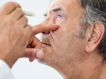 Día del glaucoma. ¿Qué es y cómo tratarlo? Día del glaucoma. ¿Qué es y cómo tratarlo?