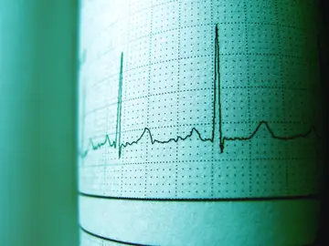 La proteína apoB predice el infarto al corazón La proteína apoB predice el infarto al corazón