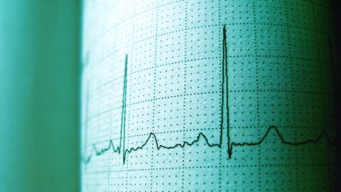 La proteína apoB predice el infarto al corazón