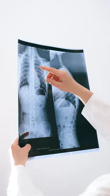 El cáncer de pulmón cambia su perfil de paciente, con más impacto en mujeres y jóvenes El cáncer de pulmón cambia su perfil de paciente, con más impacto en mujeres y jóvenes