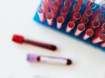 El análisis de ciertas proteínas en la sangre permite predecir qué organos fallarán antes El análisis de ciertas proteínas en la sangre permite predecir qué organos fallarán antes