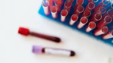 El análisis de ciertas proteínas en la sangre permite predecir qué organos fallarán antes