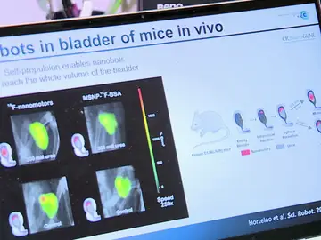 Una investigación liderada por Samuel Sánchez, premio Constantes y Vitales a Joven talento en investigación biomédica, consigue reducir en un 90% los tumores de vejiga utilizando nanorrobots Una investigación liderada por Samuel Sánchez, premio Constantes y Vitales a Joven talento en investigación biomédica, consigue reducir en un 90% los tumores de vejiga utilizando nanorrobots