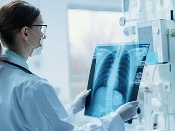 cáncer de pulmón cáncer de pulmón