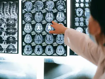 La Fundación Reina Sofía impulsa la donación cerebral para investigar enfermedades neurodegenerativas La Fundación Reina Sofía impulsa la donación cerebral para investigar enfermedades neurodegenerativas