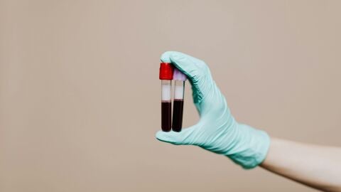 Botes de sangre para análisis