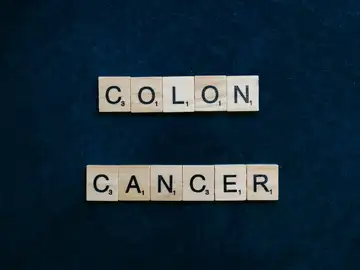Hay una relación entre el aumento de los casos de cáncer de colon y nuestros nuevos hábitos nutricionales Hay una relación entre el aumento de los casos de cáncer de colon y nuestros nuevos hábitos nutricionales