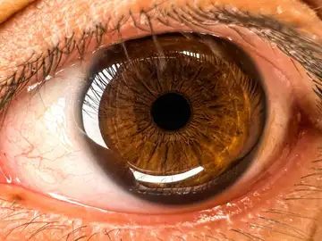 Un estudio apunta a la retina como clave para detectar el Alzheimer Un estudio apunta a la retina como clave para detectar el Alzheimer