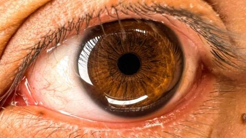 Un estudio apunta a la retina como clave para detectar el Alzheimer