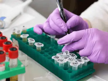 Un estudio científico explica cómo afecta la genética a la hora de perder o ganar peso Un estudio científico explica cómo afecta la genética a la hora de perder o ganar peso