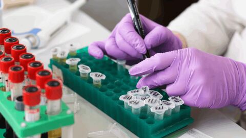 Un estudio científico explica cómo afecta la genética a la hora de perder o ganar peso