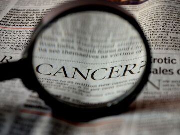 Rehabilitaci&oacute;n oncol&oacute;gica; una aliada clave antes, durante y despu&eacute;s del c&aacute;ncer