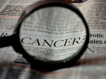 Rehabilitación oncológica; una aliada clave antes, durante y después del cáncer Rehabilitación oncológica; una aliada clave antes, durante y después del cáncer