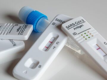 Un estudio descubre la variante gen&eacute;tica que aumenta el riesgo de contraer el covid-19 m&aacute;s grave