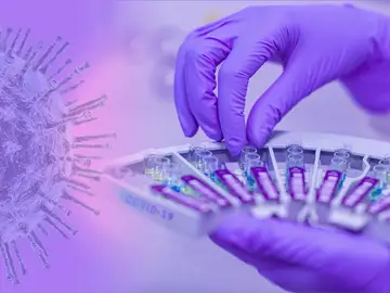 Una investigación oncológica española identifica un biomarcador genético clave para predecir la recaída en el cáncer a tiempo Una investigación oncológica española identifica un biomarcador genético clave para predecir la recaída en el cáncer a tiempo