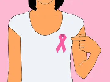 Una Investigación contra el cáncer de mama descubre como la radioterapia adaptada reduce al mínimo la reaparición del tumor Una Investigación contra el cáncer de mama descubre como la radioterapia adaptada reduce al mínimo la reaparición del tumor
