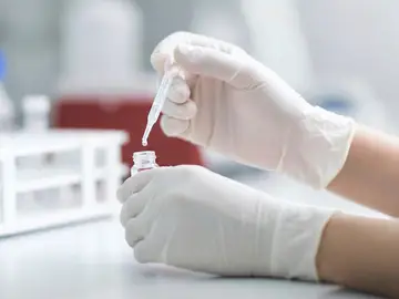 Cáncer de colon; el diagnóstico temprano de este tumor permite sobrevivir al 90 % de los pacientes Cáncer de colon; el diagnóstico temprano de este tumor permite sobrevivir al 90 % de los pacientes