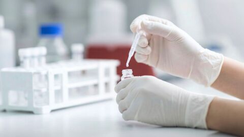 Cáncer de colon; el diagnóstico temprano de este tumor permite sobrevivir al 90 % de los pacientes