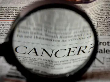 La metástasis una realidad poco visible que necesita más recursos y conocimiento para su investigación La metástasis una realidad poco visible que necesita más recursos y conocimiento para su investigación