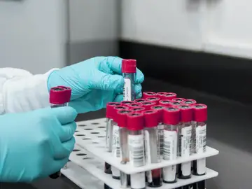 Diagnóstico ultrarrápido del cáncer de páncreas con una simple muestra de sangre Diagnóstico ultrarrápido del cáncer de páncreas con una simple muestra de sangre