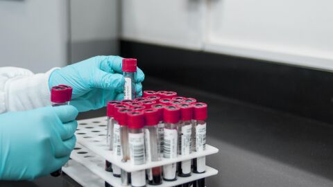 Diagnóstico ultrarrápido del cáncer de páncreas con una simple muestra de sangre