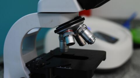 Cáncer de mama: una IA sueca logra detectar los primeros signos de tumor hasta 6 años antes que los médicos