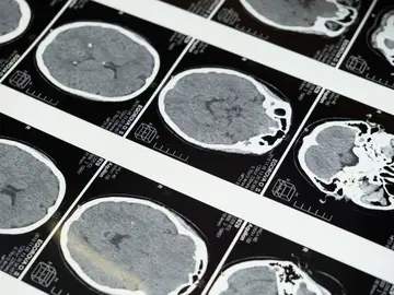 El cerebro adulto sabe repararse a sí mismo mejor de lo que se pensaba, según un nuevo estudio El cerebro adulto sabe repararse a sí mismo mejor de lo que se pensaba, según un nuevo estudio