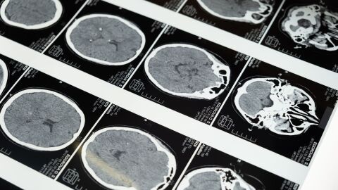 El cerebro adulto sabe repararse a sí mismo mejor de lo que se pensaba, según un nuevo estudio