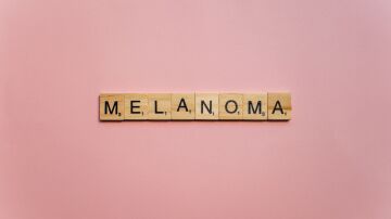 Letras de Scrabble de madera escribiendo 'Melanoma' sobre un fondo rosa suave, simbolizando la concienciaci&oacute;n.
